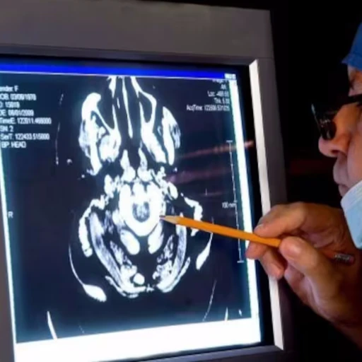 Identifican cambios tempranos en el cerebro de personas en riesgo de padecer alzhéimer